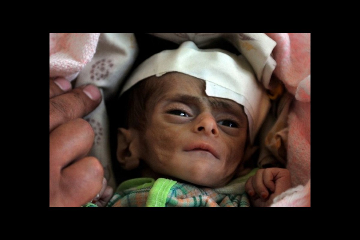 More than 250 million people worldwide are at risk of acute hunger and starvation in 2022