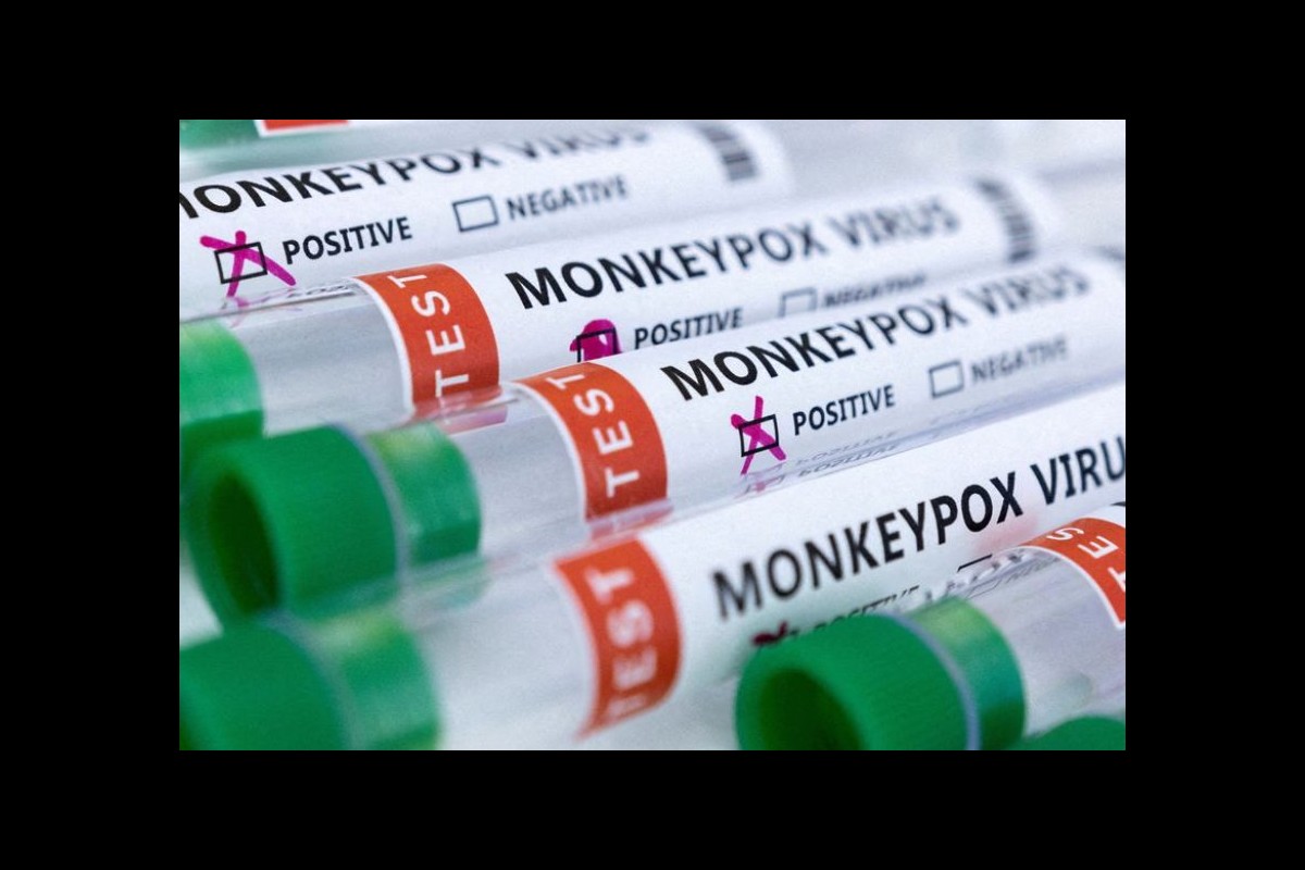 WHO declares end of monkeypox health emergency