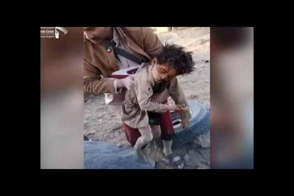 Yemen, 8,000 children killed in Saudi attacks