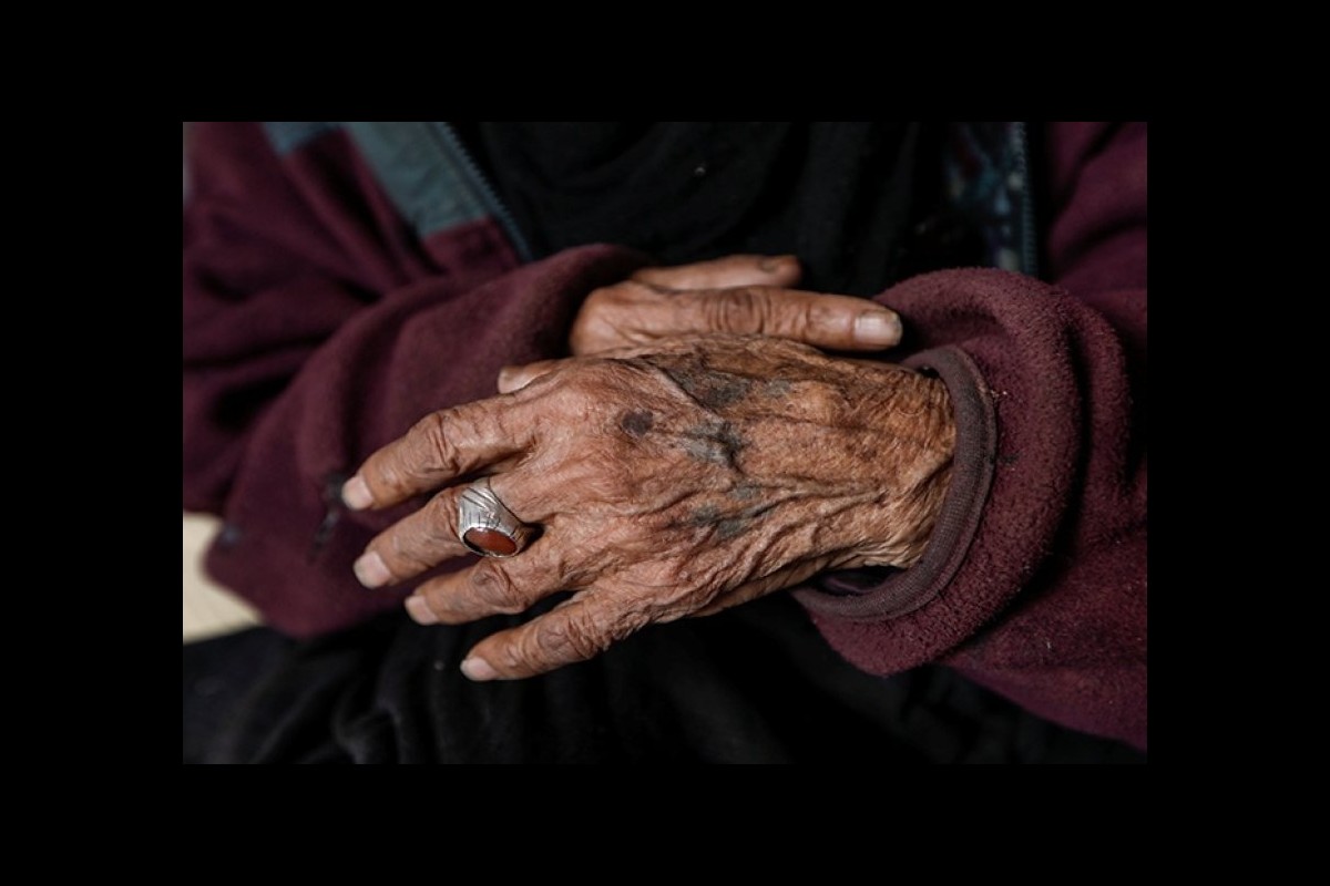 Ajuza of Iraq, who lived the longest, died at the age of 138