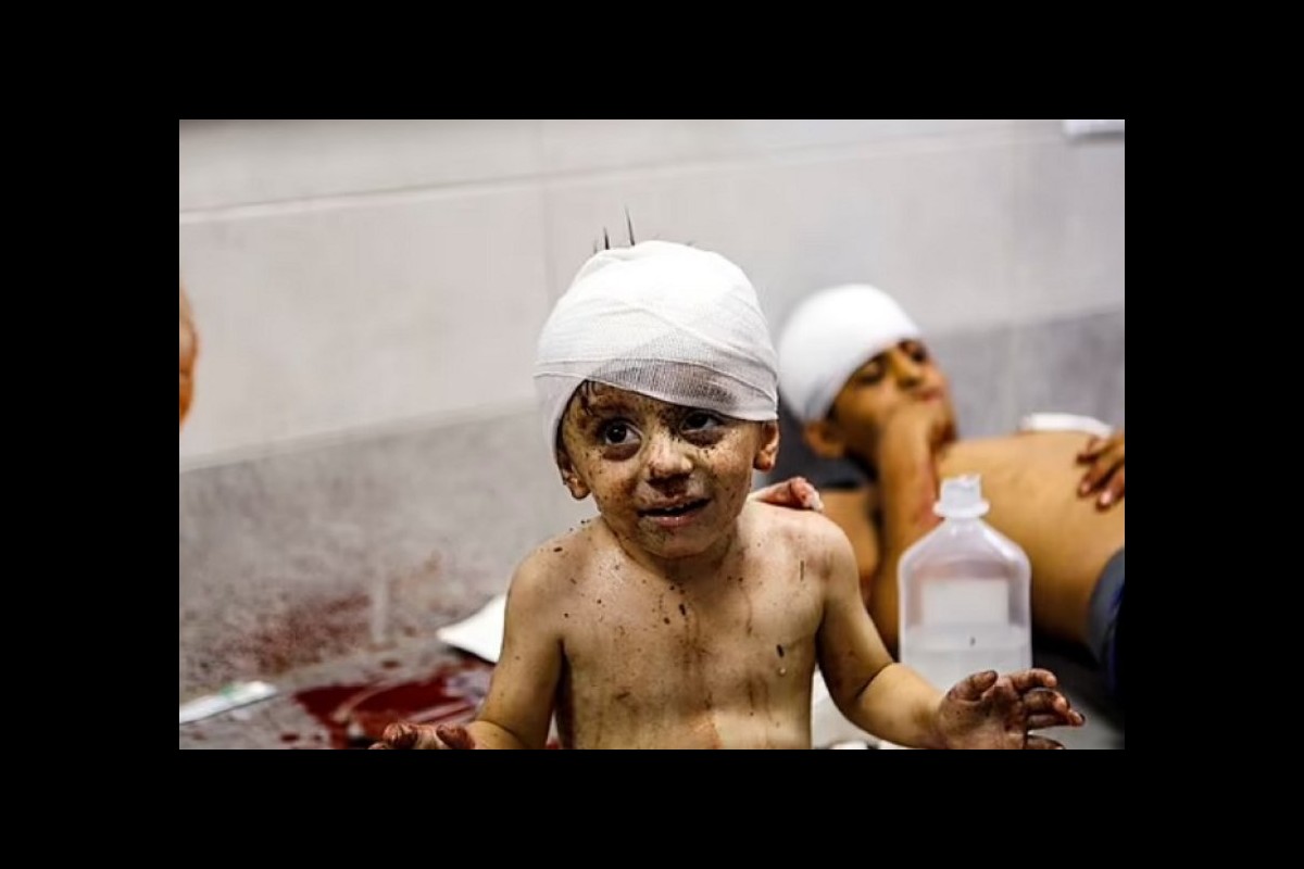 Israel kills 100 Palestinian children every day