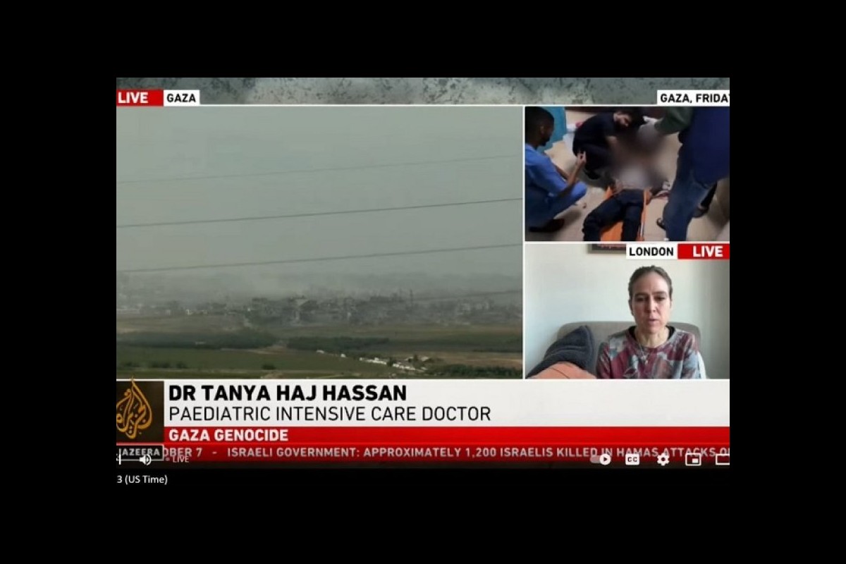 MSF warns of the amputation of thousands of children in Israel's attacks on Gaza