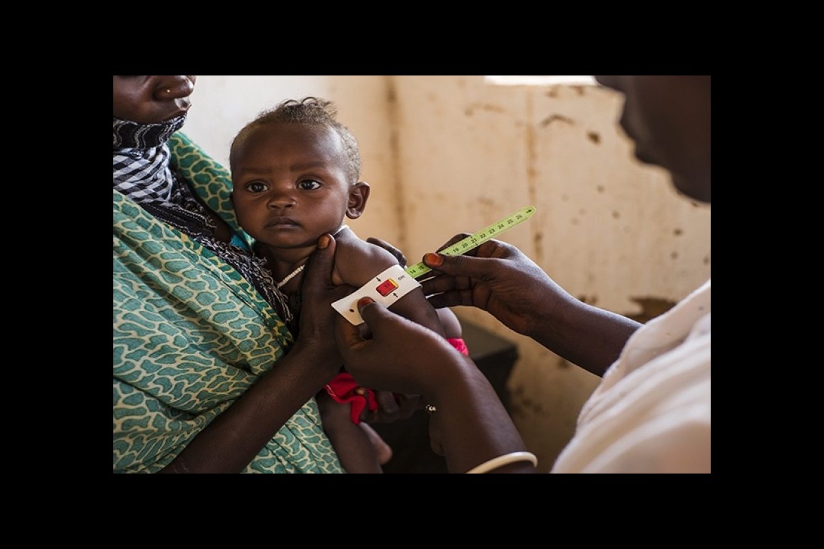 UNHCR: One out of every two refugee children is malnourished in Ethiopia
