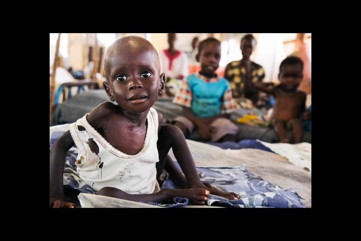 OCHA: The people of Sudan are suffering from cruelty, hunger and disease