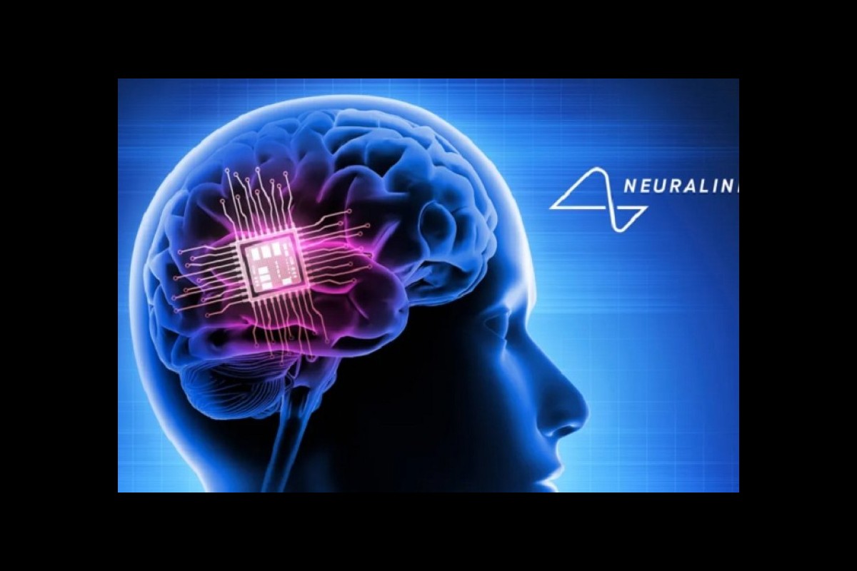 In 10 years, Neuralink implants will be placed in the brains of millions of people