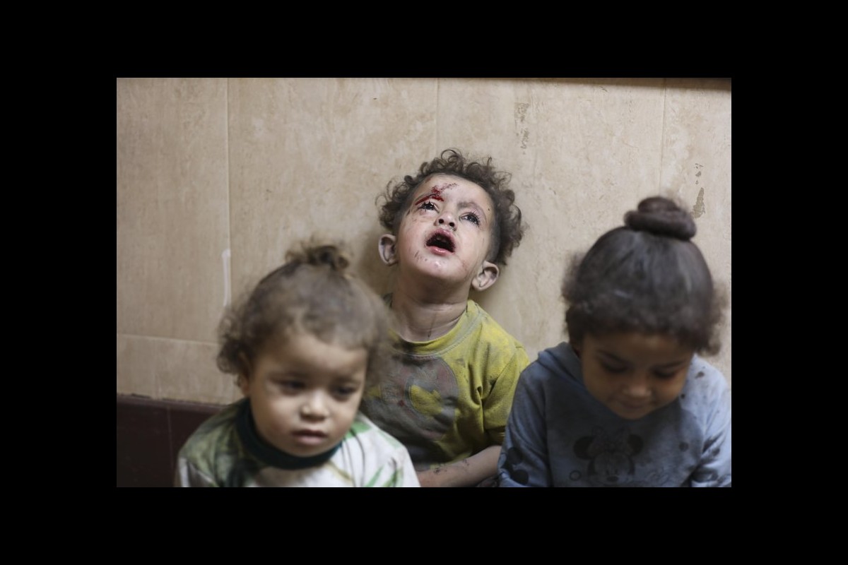 Broken Bodies, Broken Dreams: The Harrowing Toll of Israeli War on Gaza’s Children