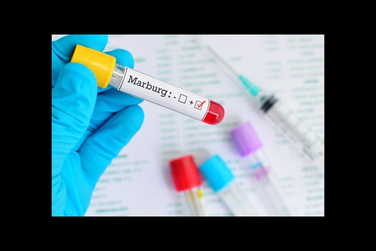 WHO to help Rwanda deal with the first outbreak of Marburg