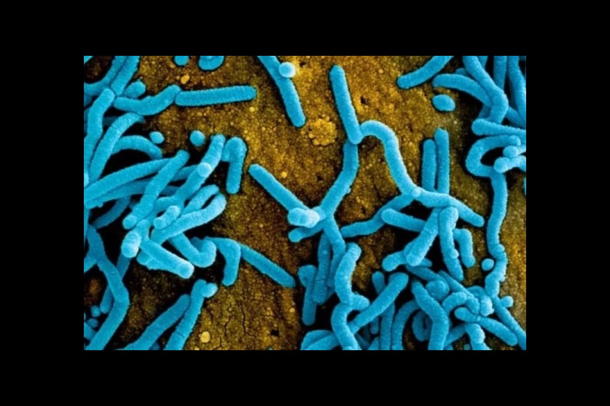Rwanda controls the number of people attending funerals after the Marburg virus outbreak