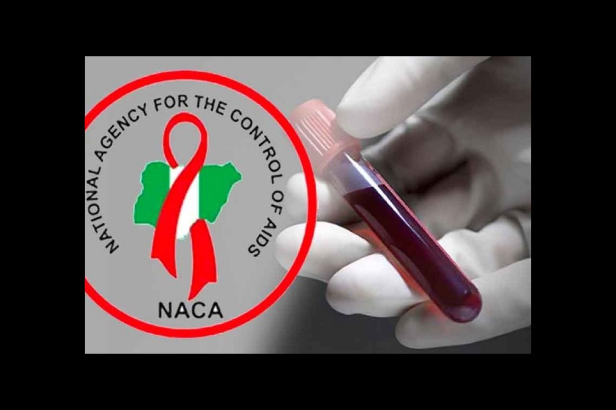 Nigeria reports 15,000 AIDS-related deaths each year