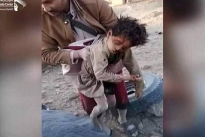 Yemen, 8,000 children killed in Saudi attacks