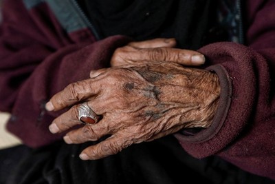Ajuza of Iraq, who lived the longest, died at the age of 138
