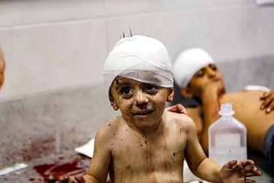 Israel kills 100 Palestinian children every day