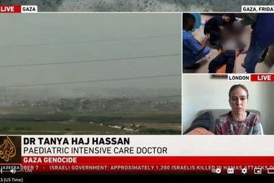 MSF warns of the amputation of thousands of children in Israel's attacks on Gaza