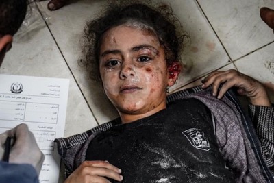 DCI: The year 2023 is the worst year for Palestinian children