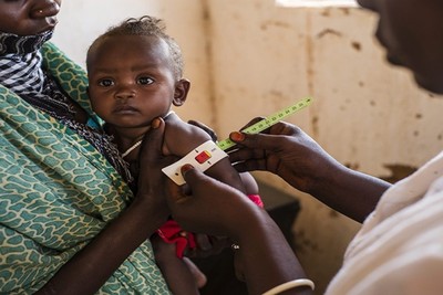 UNHCR: One out of every two refugee children is malnourished in Ethiopia