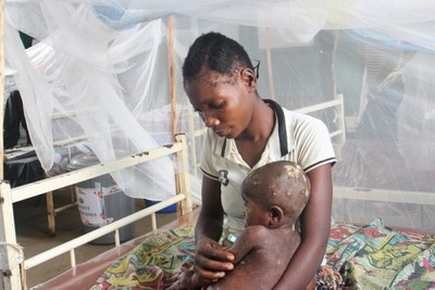 The Democratic Republic of Congo will warn about the increase in MPOX