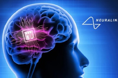 In 10 years, Neuralink implants will be placed in the brains of millions of people