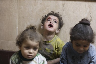Broken Bodies, Broken Dreams: The Harrowing Toll of Israeli War on Gaza’s Children