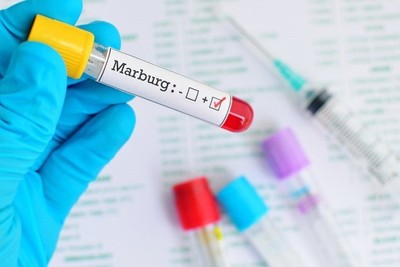 WHO to help Rwanda deal with the first outbreak of Marburg