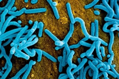 Rwanda controls the number of people attending funerals after the Marburg virus outbreak