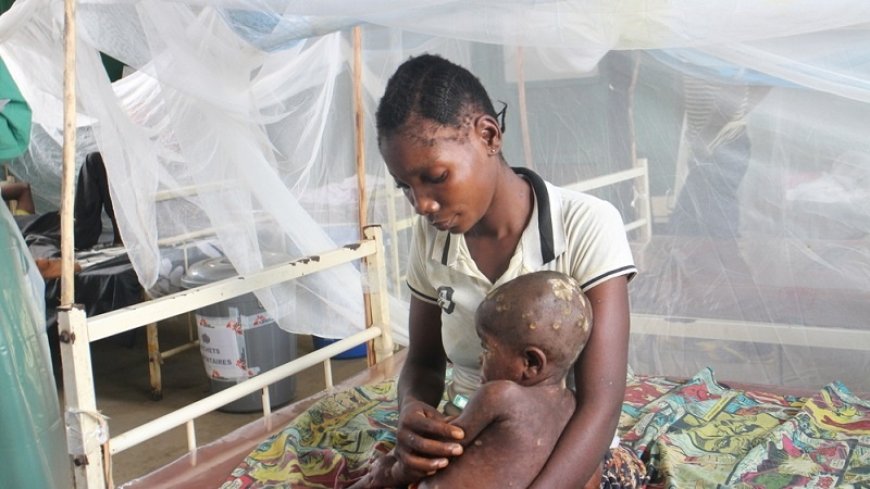 The Democratic Republic of Congo will warn about the increase in MPOX