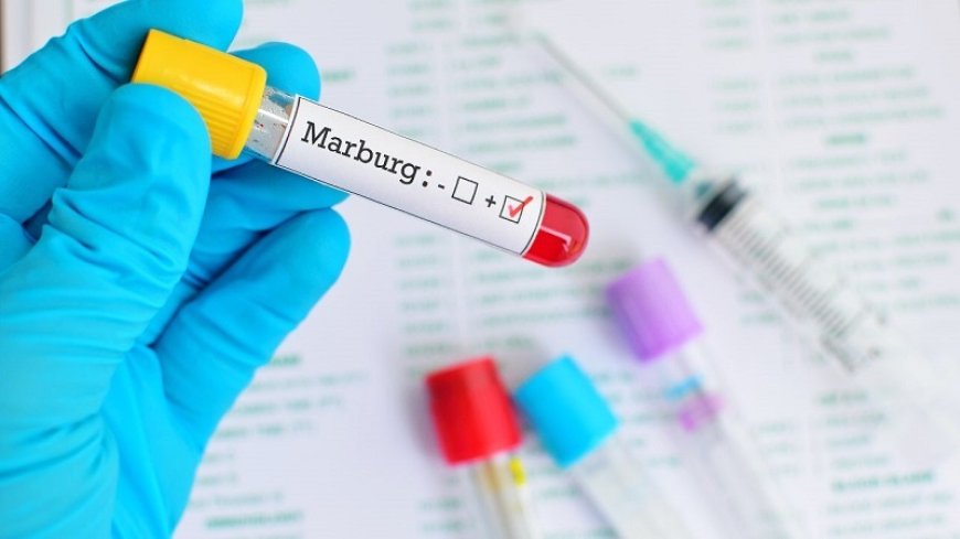 WHO to help Rwanda deal with the first outbreak of Marburg